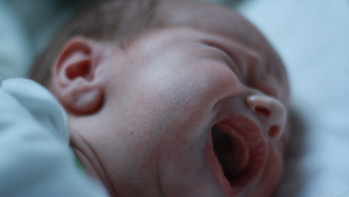 Circumcision