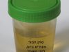 רפואות בתלמוד הבבלי