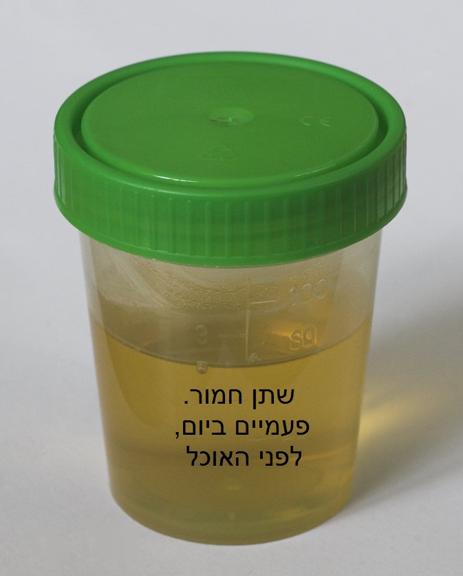 רפואות בתלמוד הבבלי